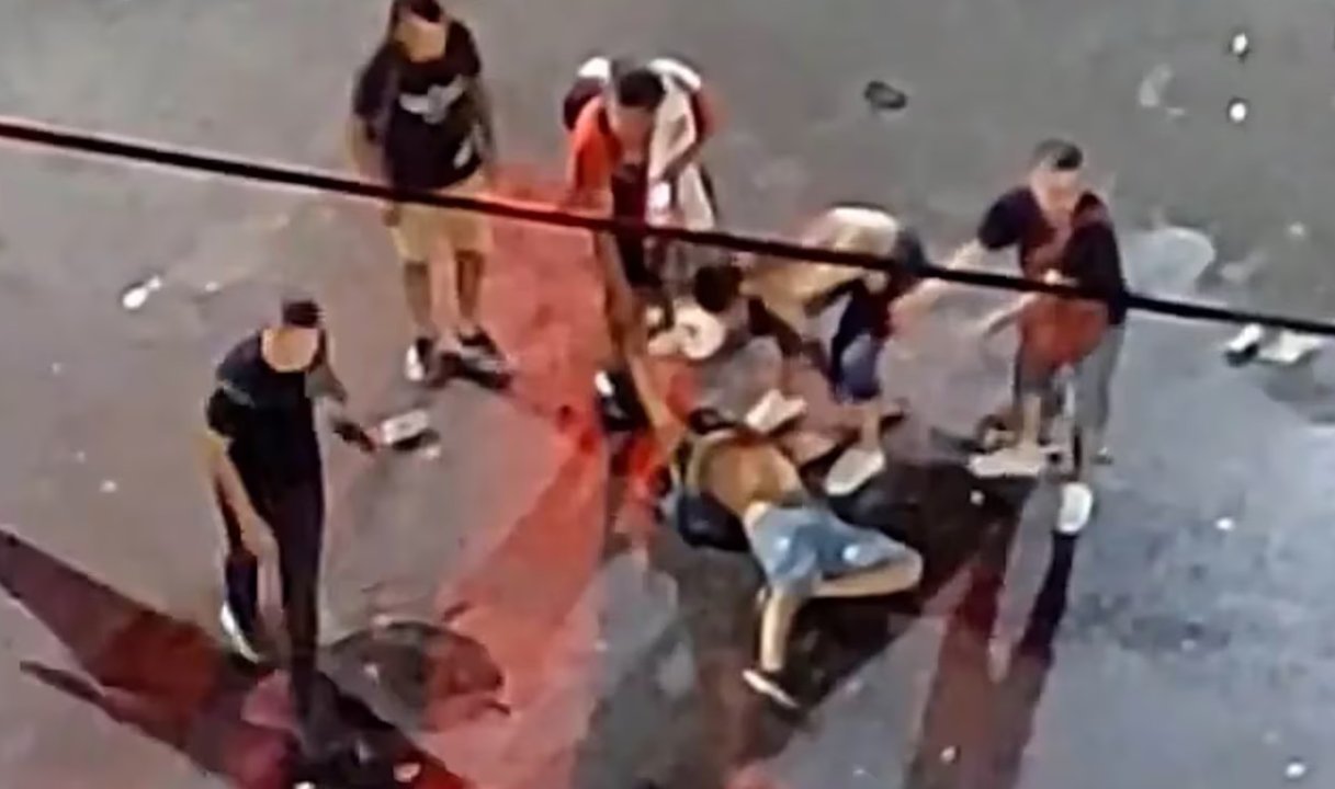 Recital de La Renga: empleado de seguridad noqueó a un fanático y lo dejó en terapia intensiva