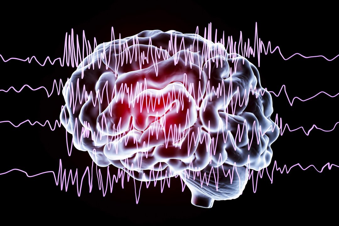Miedo, incertidumbre y estigma: los desafíos cotidianos de vivir con epilepsia