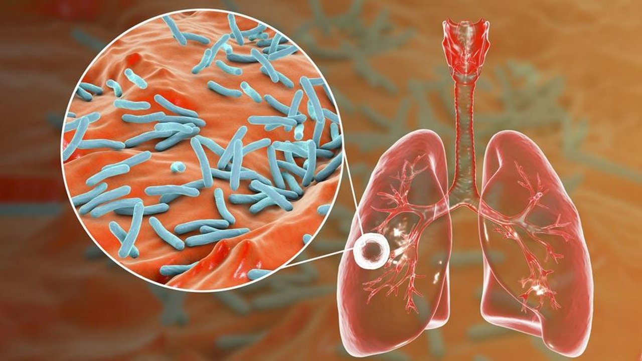 Profesional de la salud analiza estudios de tuberculosis
