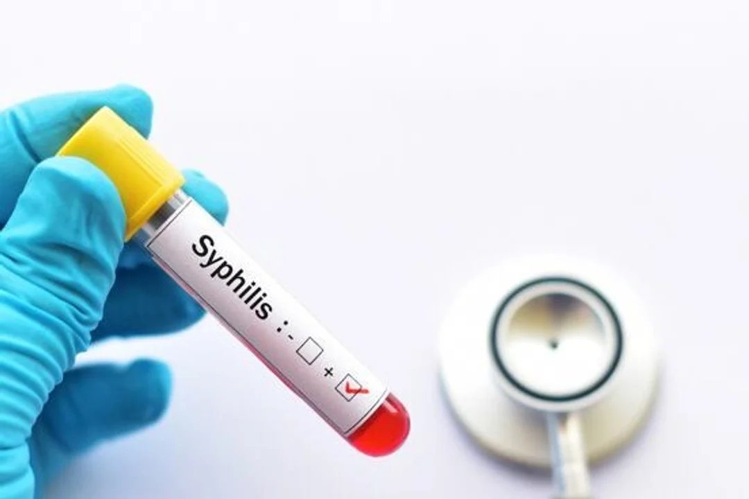 Aumento alarmante de casos de sífilis en Argentina: más de 46.000 en 2025