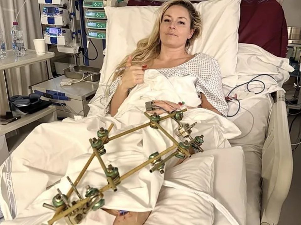 Cristiano Ronaldo envía un mensaje de apoyo a Lindsey Vonn