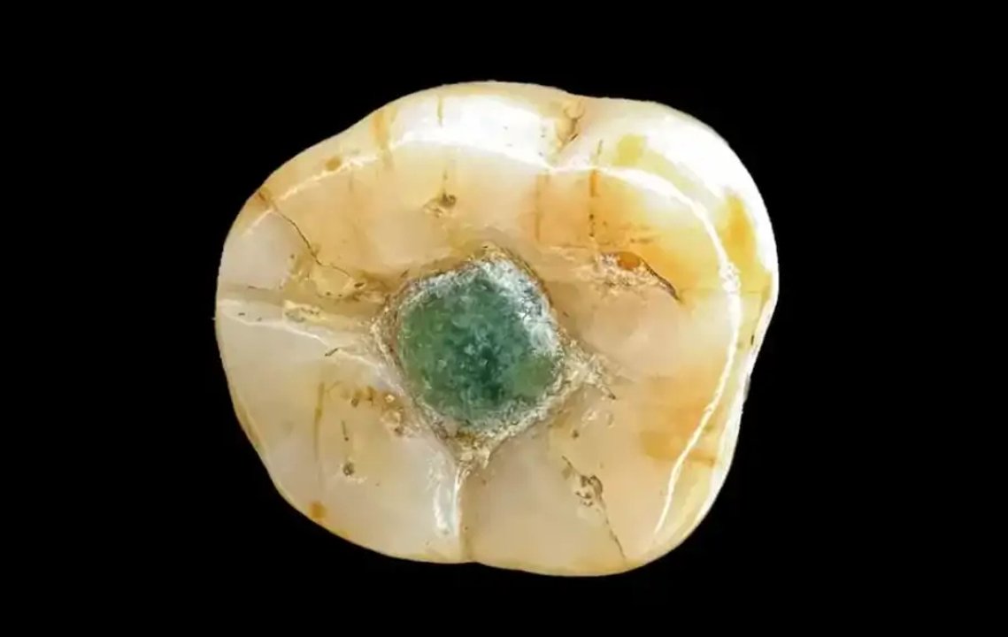 Recreación de un molar maya con incrustación de piedra verde