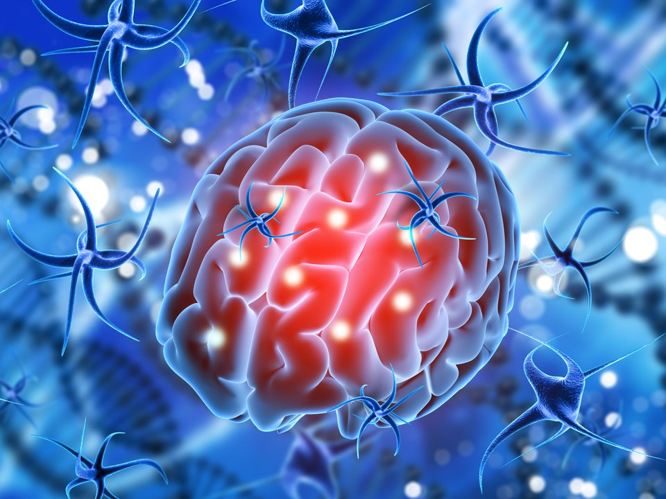 Llega a Argentina una terapia que es la primera innovación para gliomas en más de 20 años