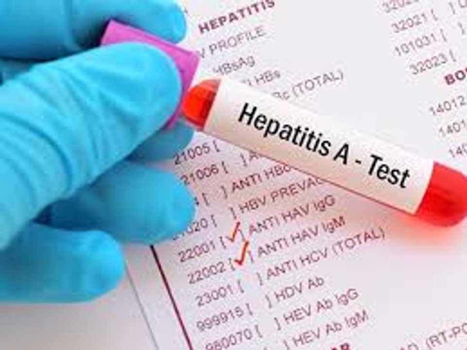 Vigilancia ambiental revela circulación de hepatitis A y E en el AMBA