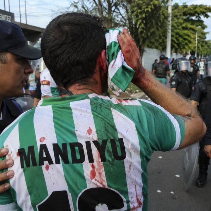 Indemnizan a hincha de Deportivo Mandiyú que perdió un ojo por disparo policial