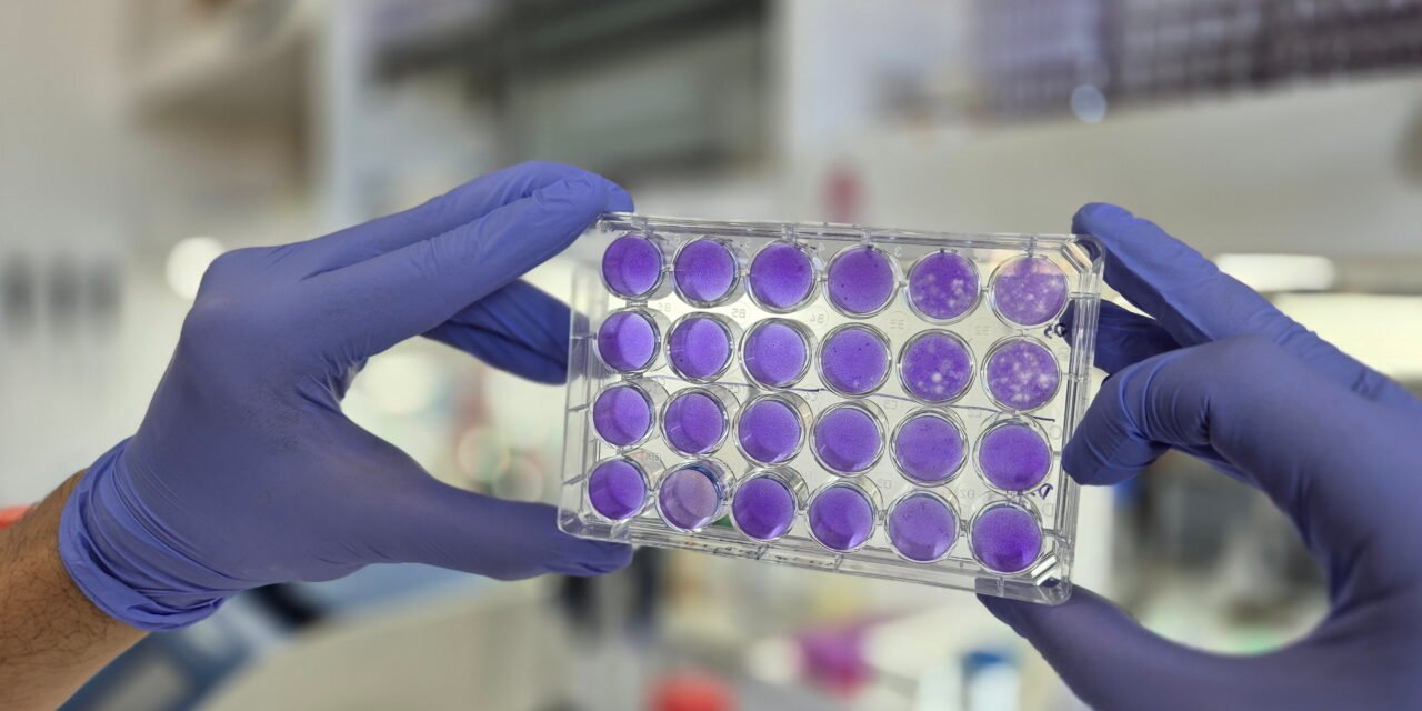 Argentinos hallan que dengue, Zika y fiebre amarilla se replican del mismo modo: se viene un antiviral