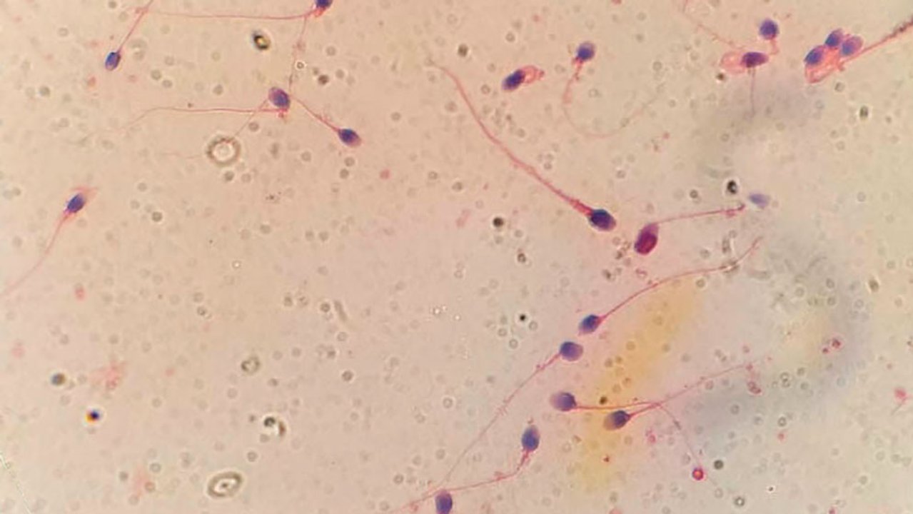 Laboratorio donde se investiga la tecnología HyperSperm