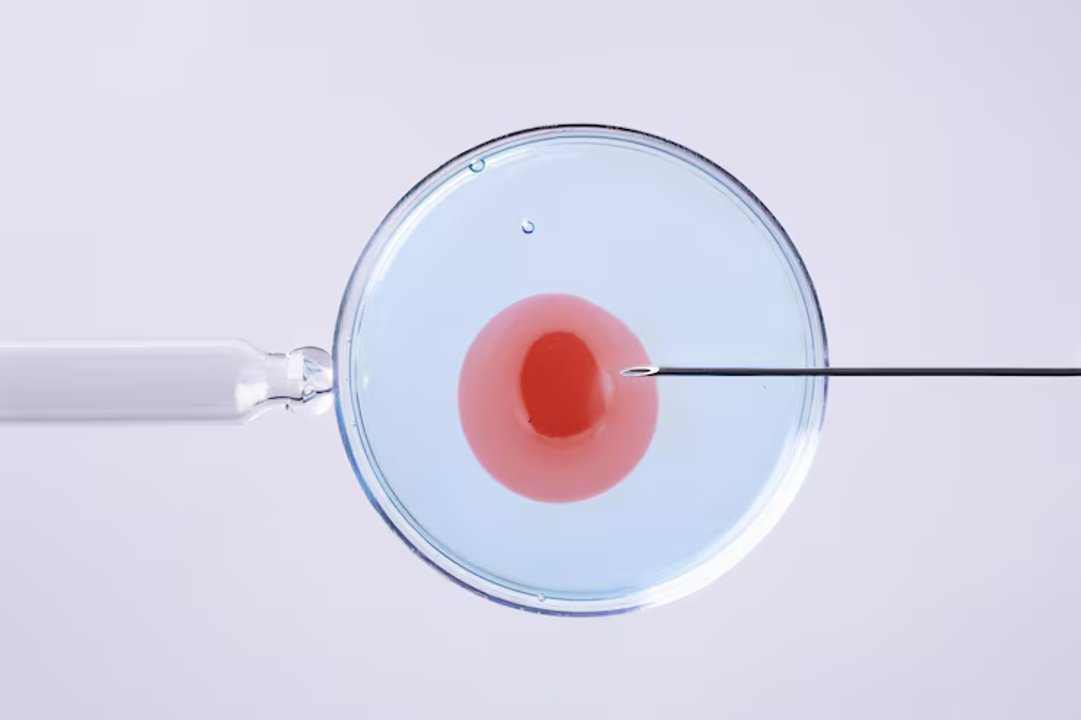 FIV o ICSI: las diferencias entre las dos técnicas más utilizadas de fertilización asistida