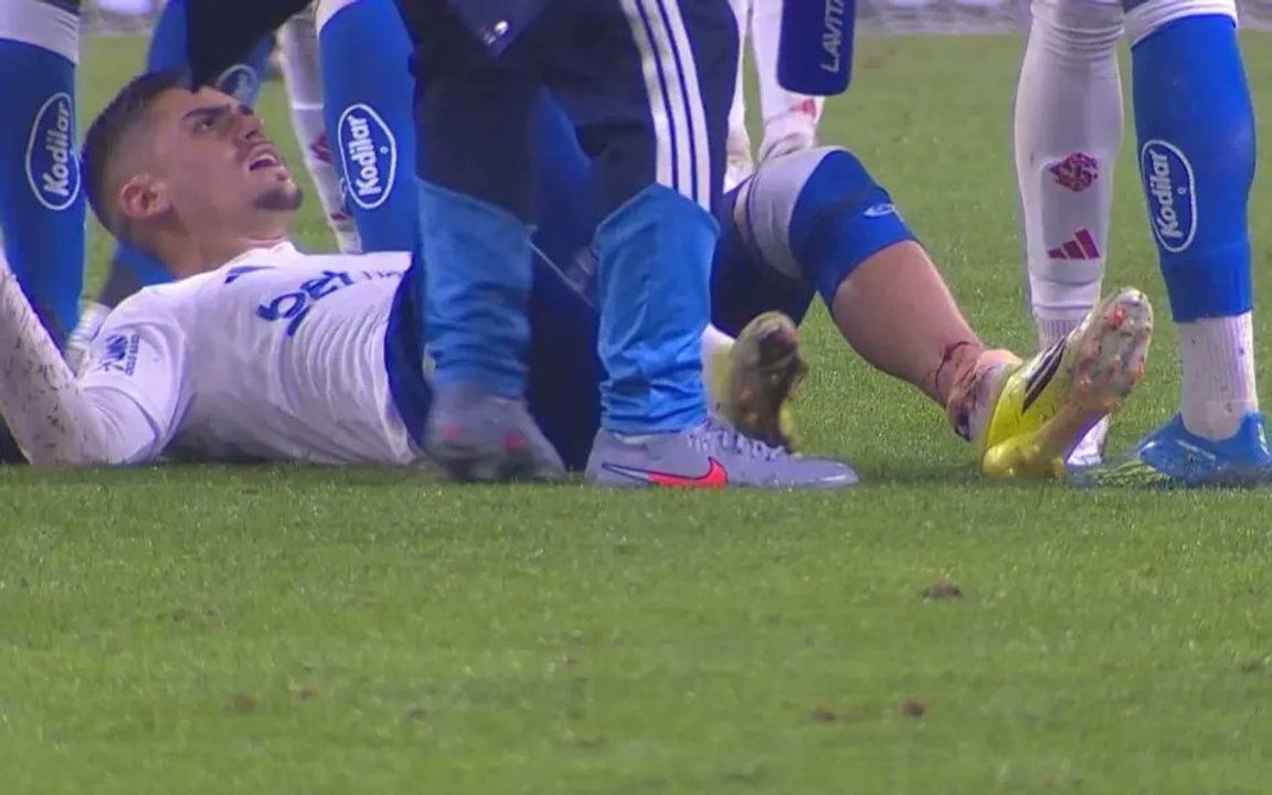 IMÁGENES SENSIBLES: la impactante lesión que sufrió un futbolista en Brasil