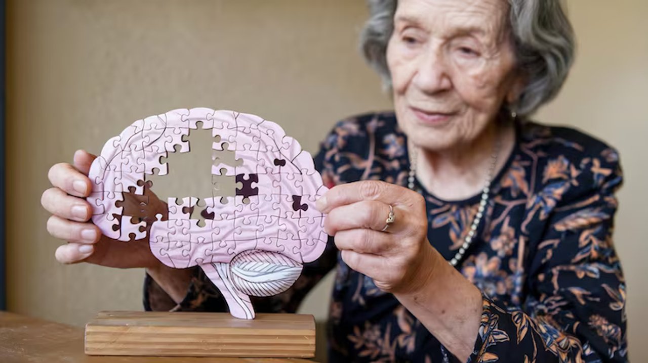El Alzheimer: un proceso que comienza mucho antes del diagnóstico