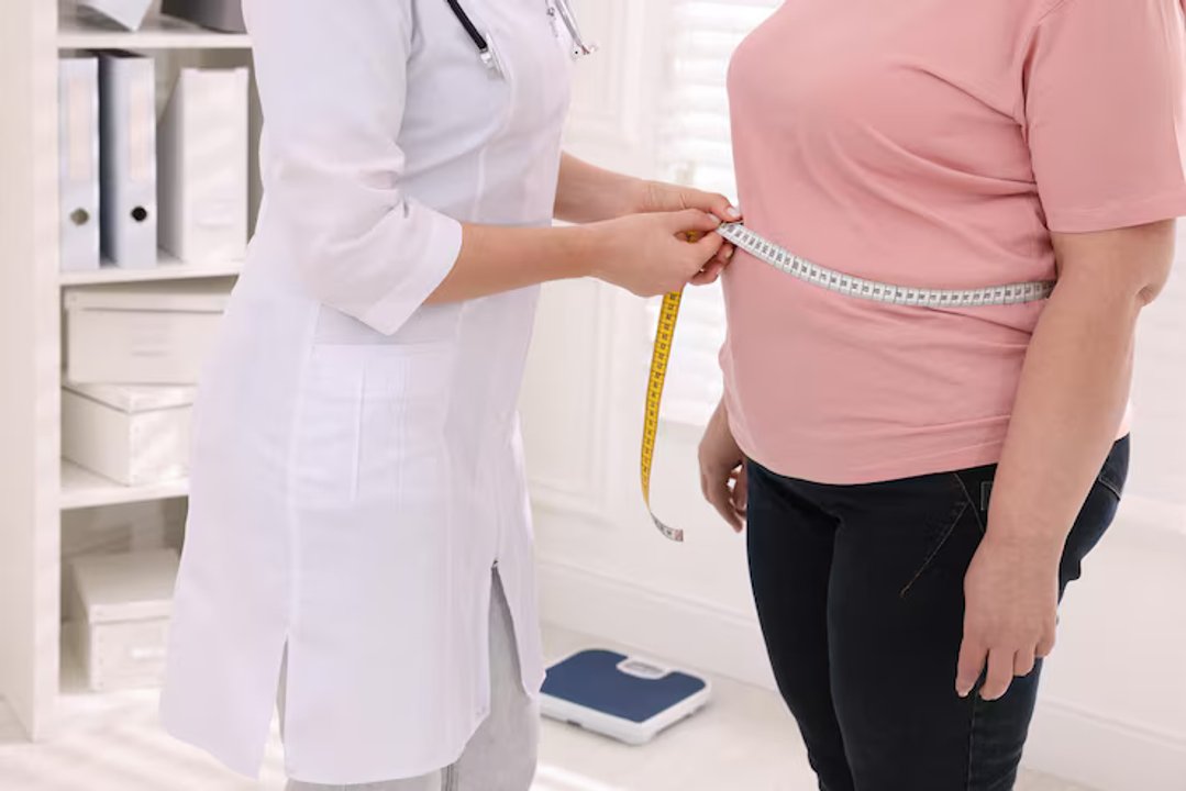 Obesidad: un desafío que requiere respuestas colectivas