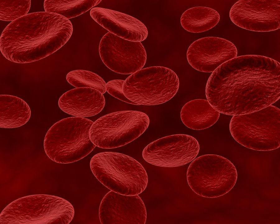 Cuando la anemia no es “solo anemia”: la señal que puede esconder un cáncer poco conocido de la médula ósea